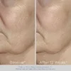 Obagi ELASTIderm Facial Serum – Firming Face Serum with Patented Bi-Mineral Cont