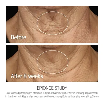 Epionce Intensive Nourishing Cream - Anti Aging Face Cream, Dry Skin Barrier Rep