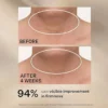 StriVectin Tighten & Lift Advanced Neck Cream PLUS with Alpha-3 Peptides for Nec